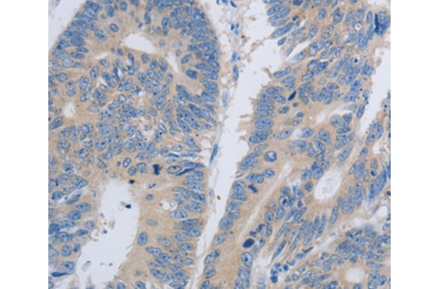 Immunohistochemistry - PAWR Antibody from Signalway Antibody (37011) - Antibodies.com