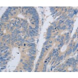 Immunohistochemistry - PAWR Antibody from Signalway Antibody (37011) - Antibodies.com