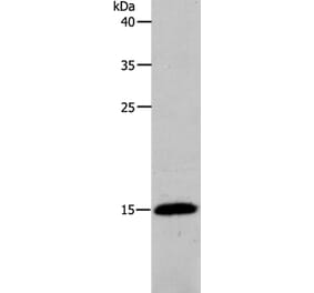 PFN2 Antibody from Signalway Antibody (37018) - Antibodies.com