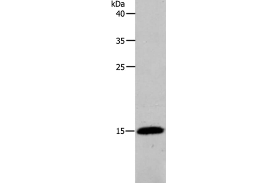 PFN2 Antibody from Signalway Antibody (37018) - Antibodies.com
