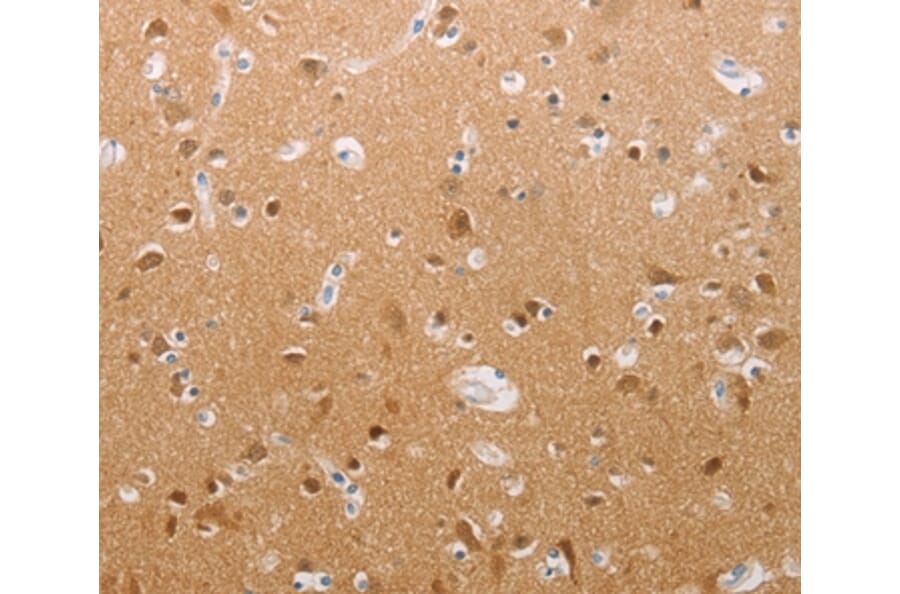 Immunohistochemistry - PFN2 Antibody from Signalway Antibody (37018) - Antibodies.com