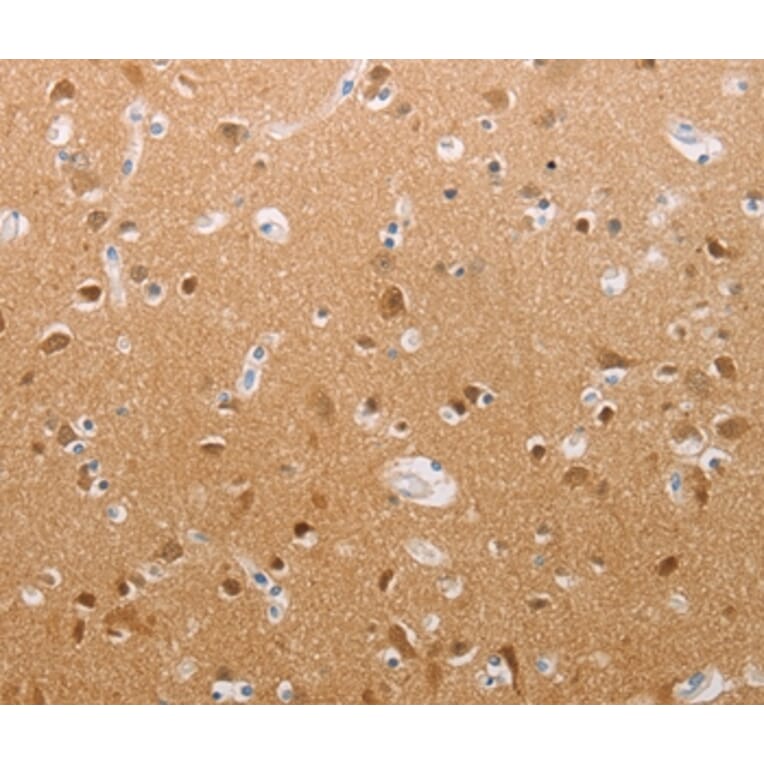 Immunohistochemistry - PFN2 Antibody from Signalway Antibody (37018) - Antibodies.com