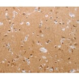 Immunohistochemistry - PFN2 Antibody from Signalway Antibody (37018) - Antibodies.com