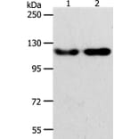 ABL2 Antibody from Signalway Antibody (37077) - Antibodies.com