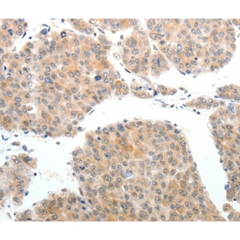 Immunohistochemistry - ABL2 Antibody from Signalway Antibody (37077) - Antibodies.com