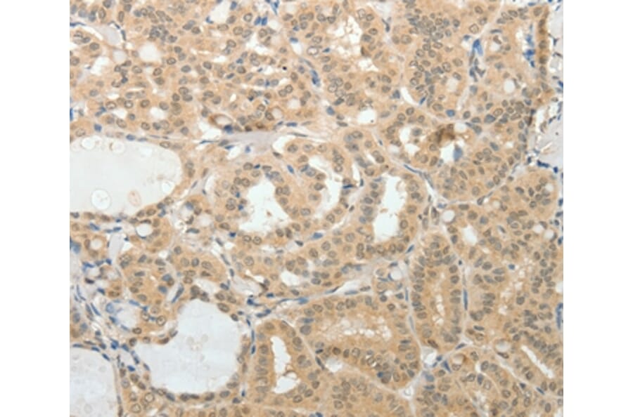 Immunohistochemistry - AFF2 Antibody from Signalway Antibody (37087) - Antibodies.com