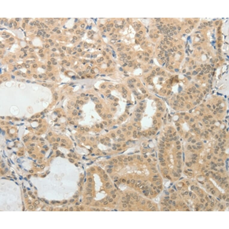 Immunohistochemistry - AFF2 Antibody from Signalway Antibody (37087) - Antibodies.com