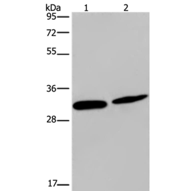 GJB4 Antibody from Signalway Antibody (37120) - Antibodies.com