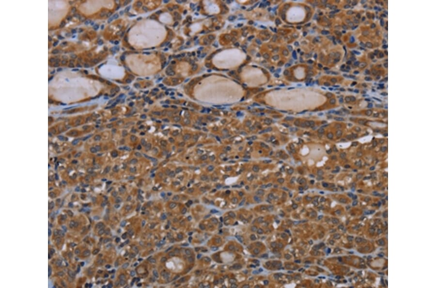 Immunohistochemistry - GJB4 Antibody from Signalway Antibody (37120) - Antibodies.com