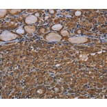 Immunohistochemistry - GJB4 Antibody from Signalway Antibody (37120) - Antibodies.com