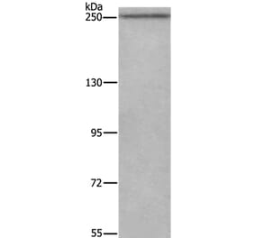 WNK3 Antibody from Signalway Antibody (37129) - Antibodies.com