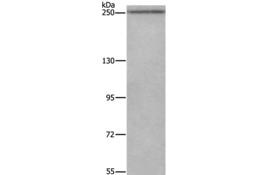 WNK3 Antibody from Signalway Antibody (37129) - Antibodies.com
