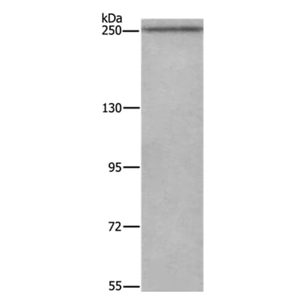 WNK3 Antibody from Signalway Antibody (37129) - Antibodies.com