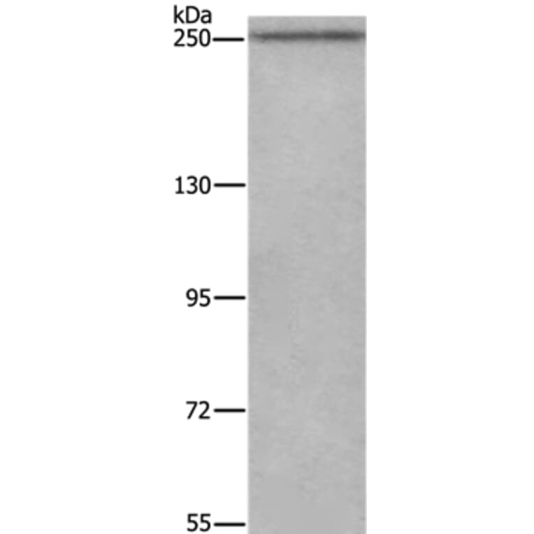 WNK3 Antibody from Signalway Antibody (37129) - Antibodies.com