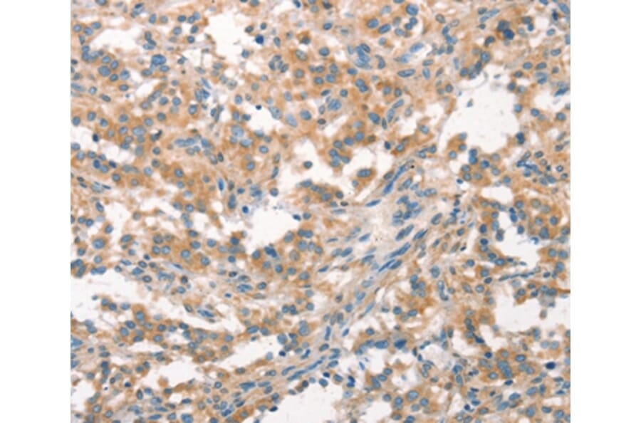 Immunohistochemistry - WNK3 Antibody from Signalway Antibody (37129) - Antibodies.com