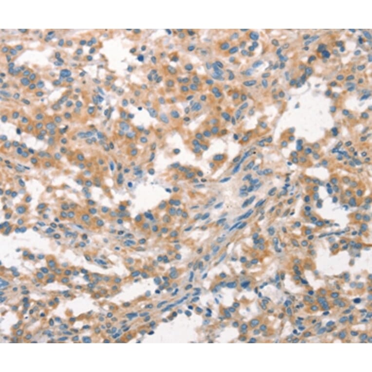 Immunohistochemistry - WNK3 Antibody from Signalway Antibody (37129) - Antibodies.com