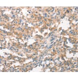 Immunohistochemistry - WNK3 Antibody from Signalway Antibody (37129) - Antibodies.com