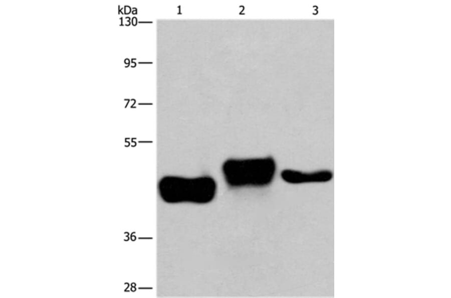 SGK2 Antibody from Signalway Antibody (37136) - Antibodies.com
