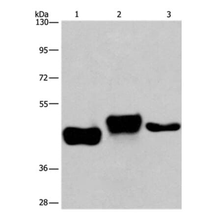 SGK2 Antibody from Signalway Antibody (37136) - Antibodies.com