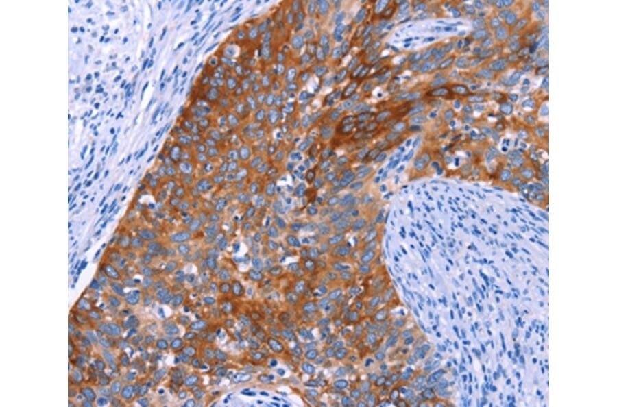 Immunohistochemistry - SGK2 Antibody from Signalway Antibody (37136) - Antibodies.com