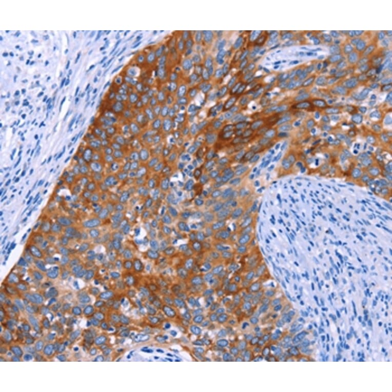 Immunohistochemistry - SGK2 Antibody from Signalway Antibody (37136) - Antibodies.com