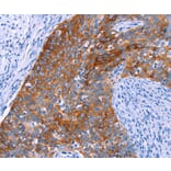 Immunohistochemistry - SGK2 Antibody from Signalway Antibody (37136) - Antibodies.com