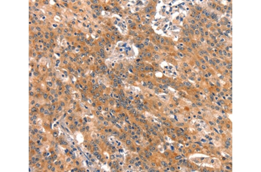 Immunohistochemistry - BCL3 Antibody from Signalway Antibody (37149) - Antibodies.com
