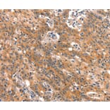 Immunohistochemistry - BCL3 Antibody from Signalway Antibody (37149) - Antibodies.com