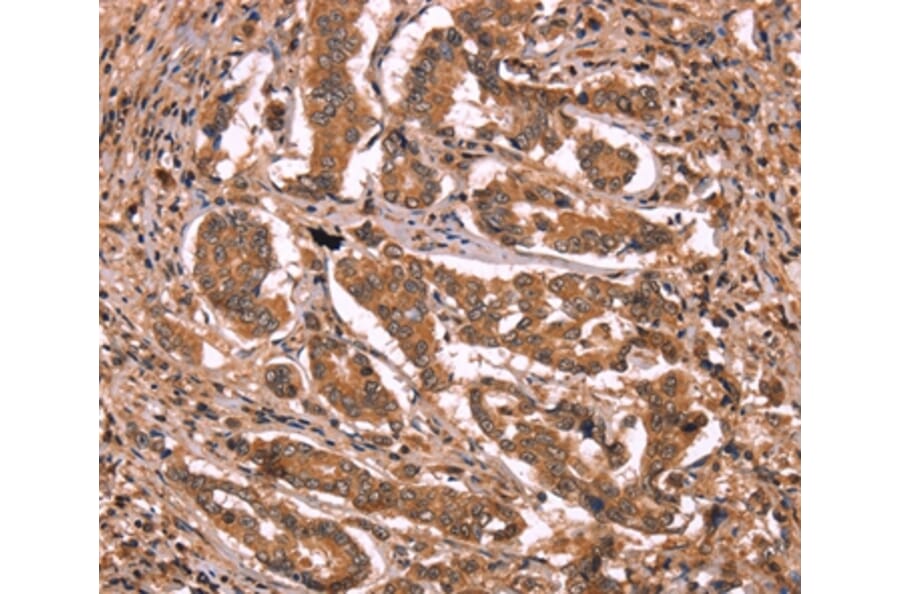 Immunohistochemistry - BCL6 Antibody from Signalway Antibody (37150) - Antibodies.com