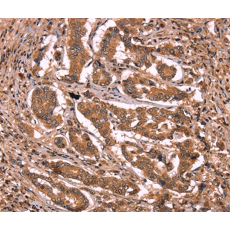 Immunohistochemistry - BCL6 Antibody from Signalway Antibody (37150) - Antibodies.com