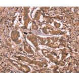 Immunohistochemistry - BCL6 Antibody from Signalway Antibody (37150) - Antibodies.com