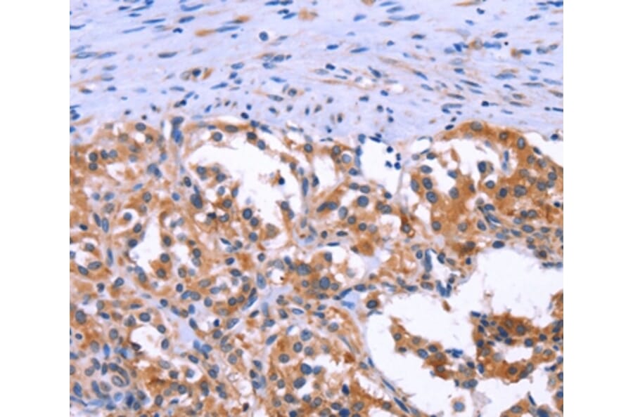 Immunohistochemistry - ANO1 Antibody from Signalway Antibody (37167) - Antibodies.com