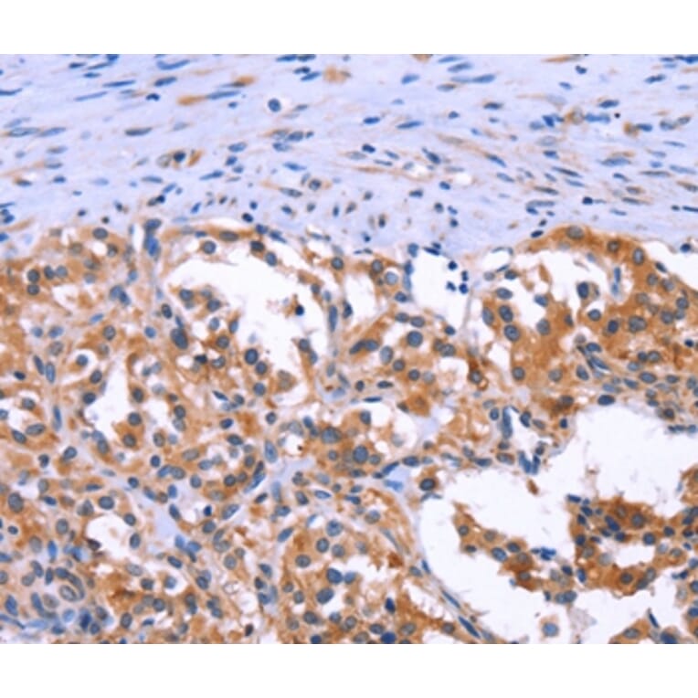 Immunohistochemistry - ANO1 Antibody from Signalway Antibody (37167) - Antibodies.com