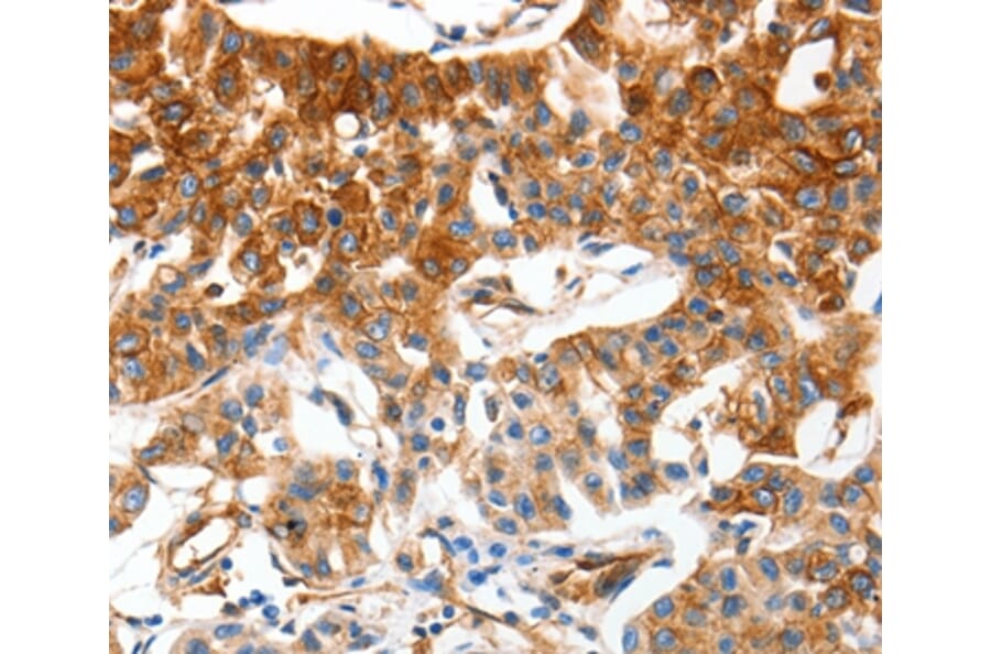 Immunohistochemistry - MCAM Antibody from Signalway Antibody (37174) - Antibodies.com