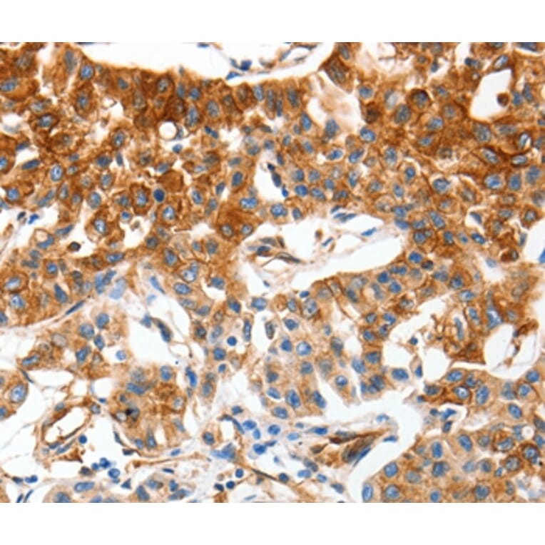 Immunohistochemistry - MCAM Antibody from Signalway Antibody (37174) - Antibodies.com
