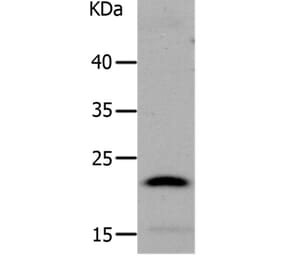 LCN2 Antibody from Signalway Antibody (37183) - Antibodies.com