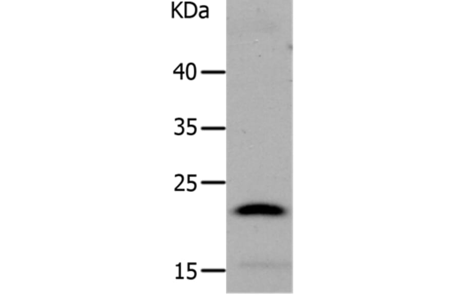 LCN2 Antibody from Signalway Antibody (37183) - Antibodies.com