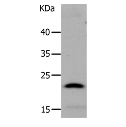 LCN2 Antibody from Signalway Antibody (37183) - Antibodies.com