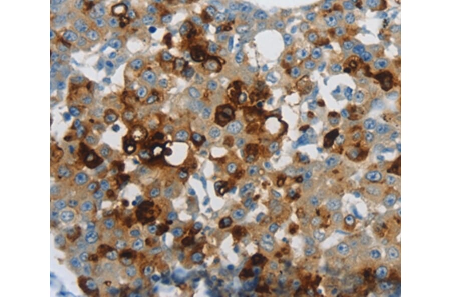 Immunohistochemistry - LCN2 Antibody from Signalway Antibody (37183) - Antibodies.com