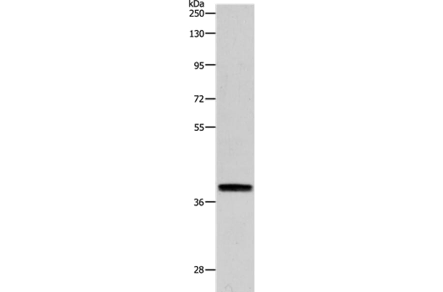 RTN4 Antibody from Signalway Antibody (37191) - Antibodies.com