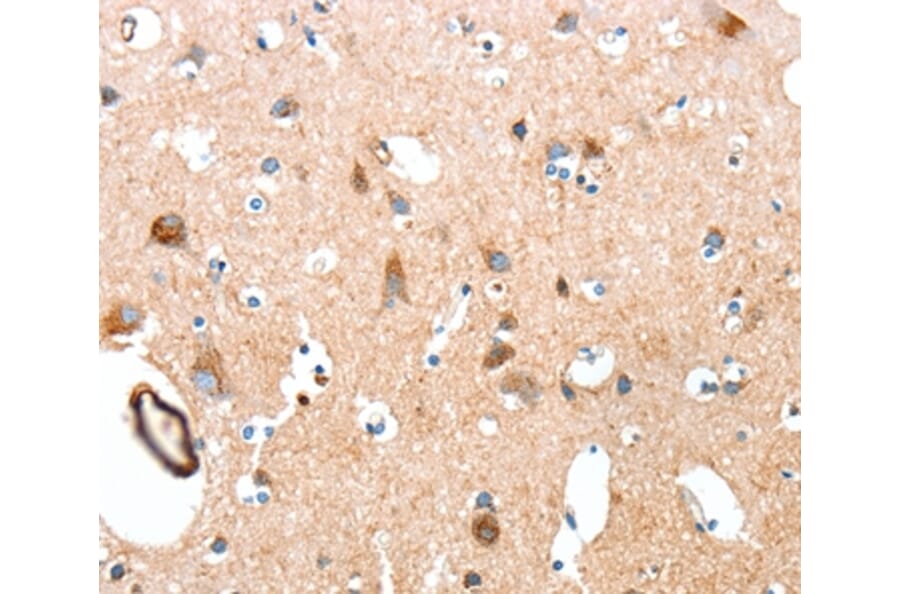 Immunohistochemistry - AARS Antibody from Signalway Antibody (37323) - Antibodies.com