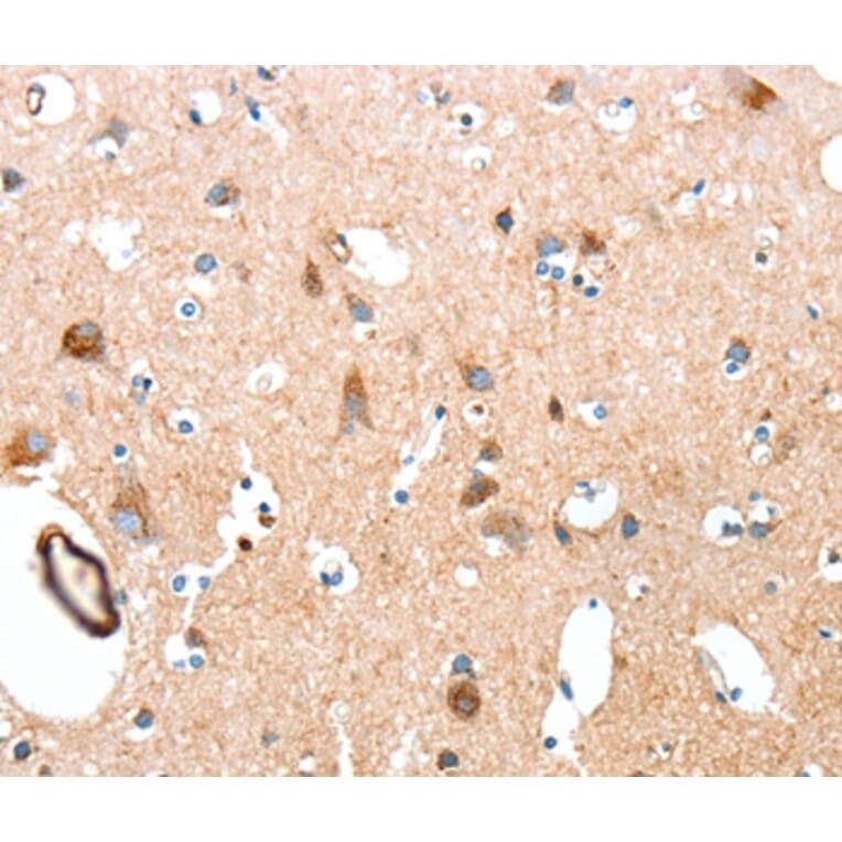Immunohistochemistry - AARS Antibody from Signalway Antibody (37323) - Antibodies.com
