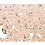 Immunohistochemistry - AARS Antibody from Signalway Antibody (37323) - Antibodies.com