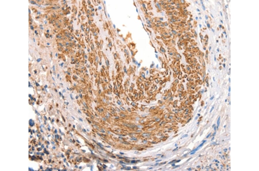Immunohistochemistry - ART4 Antibody from Signalway Antibody (37354) - Antibodies.com