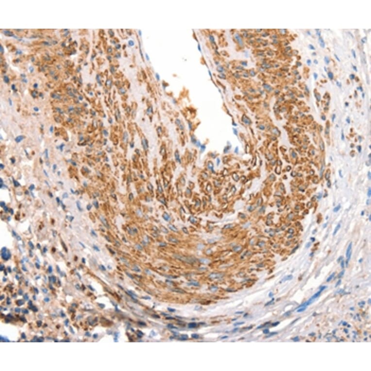 Immunohistochemistry - ART4 Antibody from Signalway Antibody (37354) - Antibodies.com