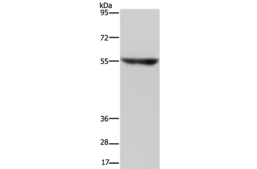 NRG3 Antibody from Signalway Antibody (37369) - Antibodies.com