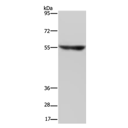NRG3 Antibody from Signalway Antibody (37369) - Antibodies.com