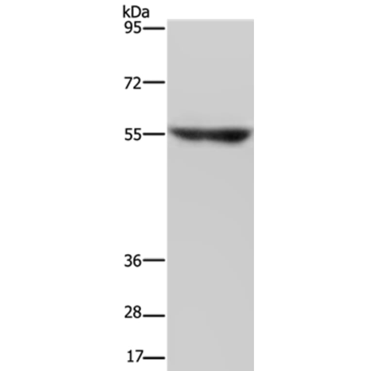 NRG3 Antibody from Signalway Antibody (37369) - Antibodies.com