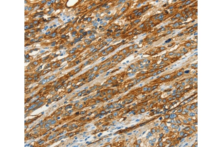 Immunohistochemistry - CAV1 Antibody from Signalway Antibody (37401) - Antibodies.com