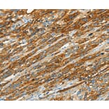 Immunohistochemistry - CAV1 Antibody from Signalway Antibody (37401) - Antibodies.com